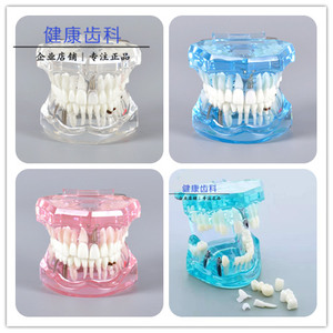 牙齒模型十大牌子排行榜